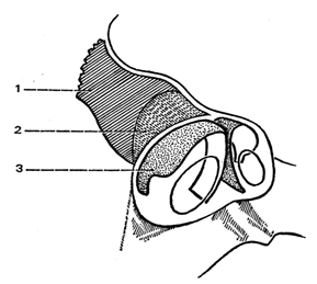 Intervento di rinoplastica